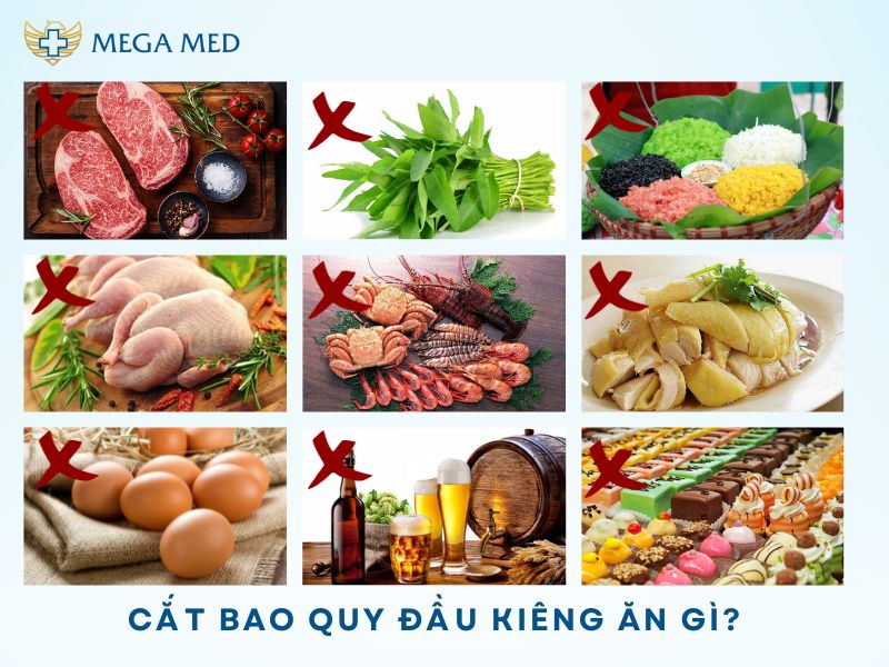 Cắt bao quy đầu kiêng gì?